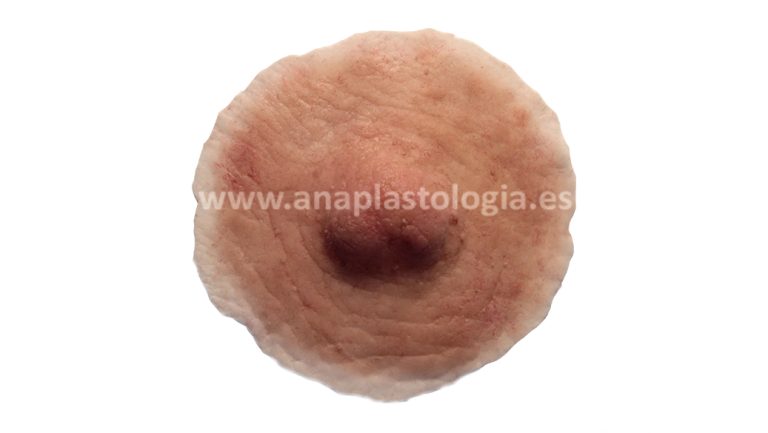 Prótesis de areola y pezón de silicona a medida