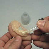 Aplicación de adhesivo médico en una prótesis auricular