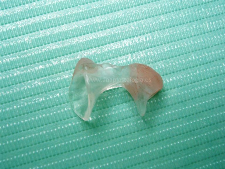 Conformador nasal transparente a medida