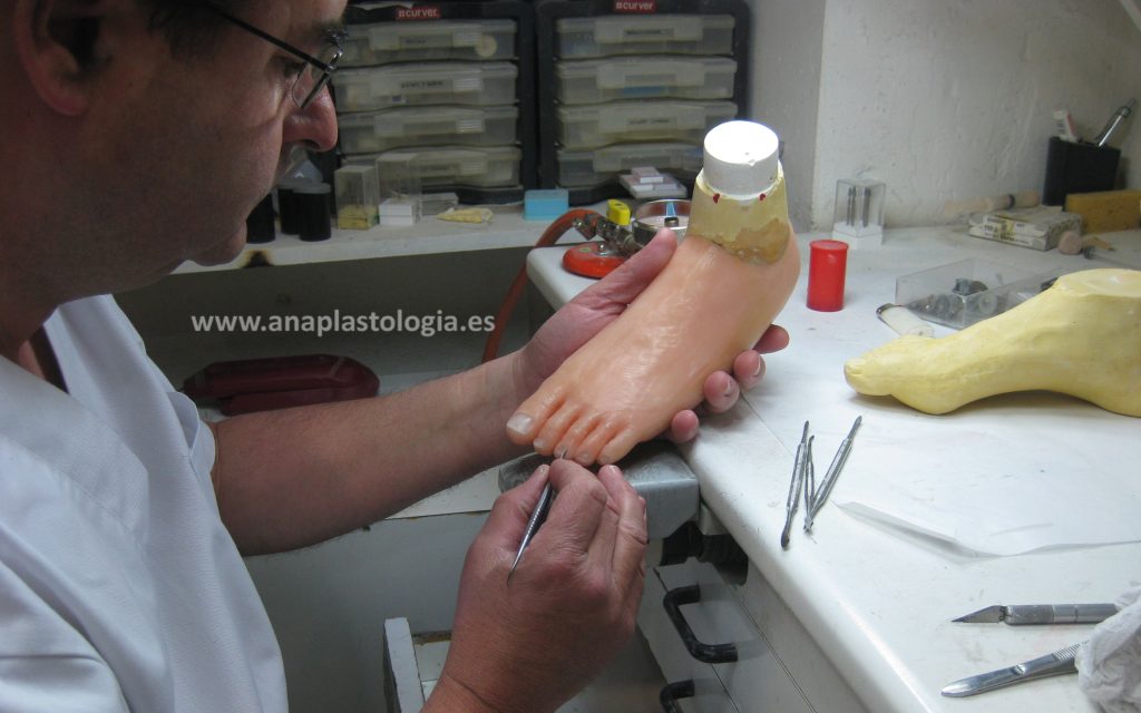 Fabricación de una prótesis de pie en el taller