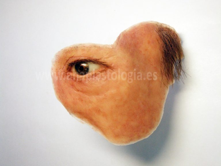 Prótesis hemifacial de silicona con ojo y ceja