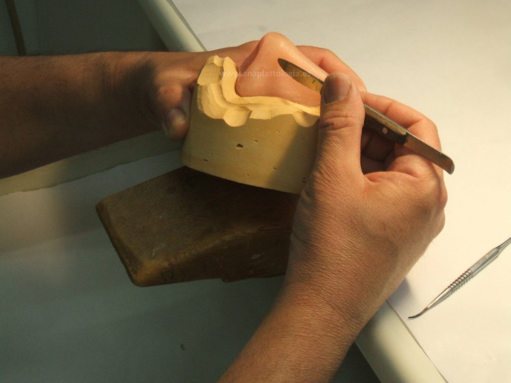 Modelado en cera de una prótesis nasal a medida