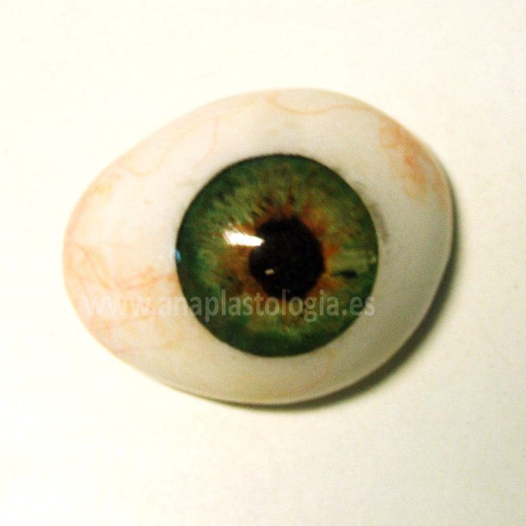 Prótesis ocular a medida con iris verde