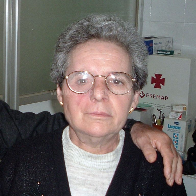 Mujer con gafas y prótesis orbitaria a medida