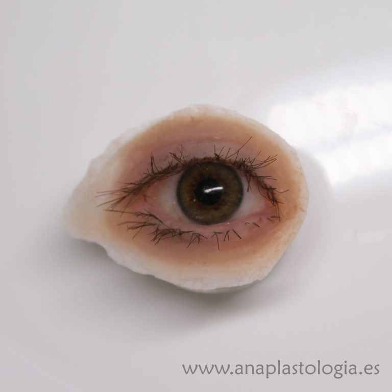 Prótesis orbitaria de silicona con ojo, párpados y pestañas