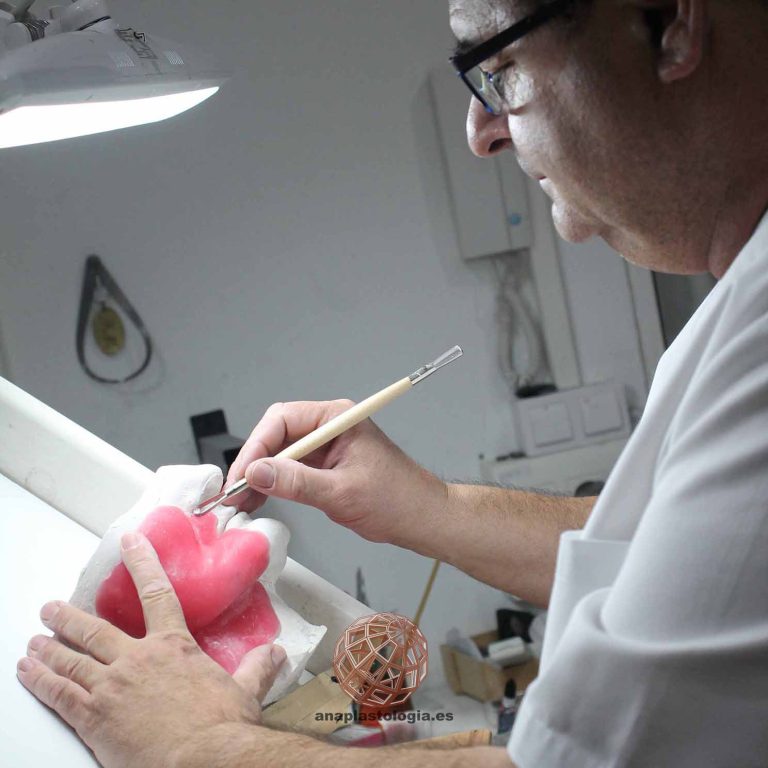 Anaplastólogo trabajando en una prótesis parche en el taller