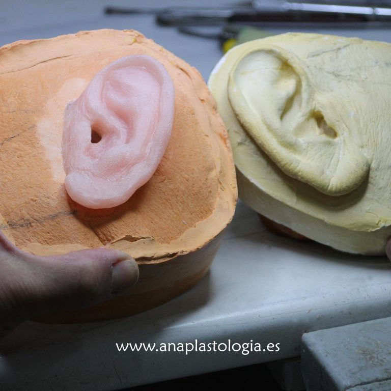 Modelado en cera de una prótesis auricular junto al molde