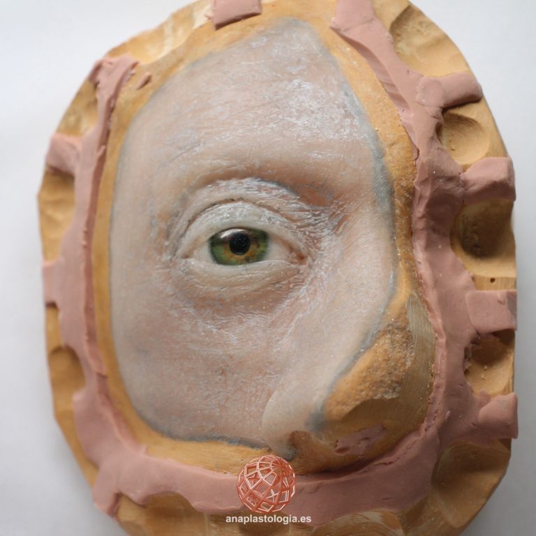 Modelado de prótesis hemifacial con ojo sobre el molde