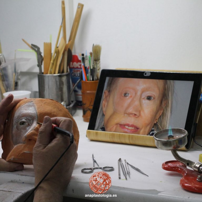 Trabajo de prótesis hemifacial en taller con referencia fotográfica