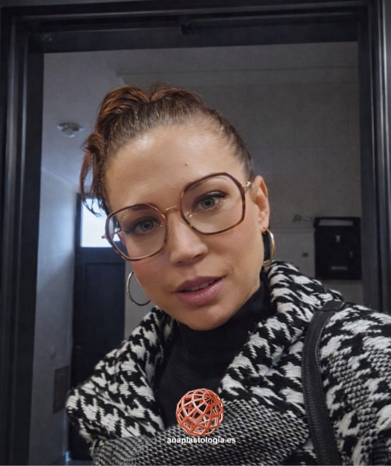 Mujer con gafas y prótesis nasal a medida, vista frontal